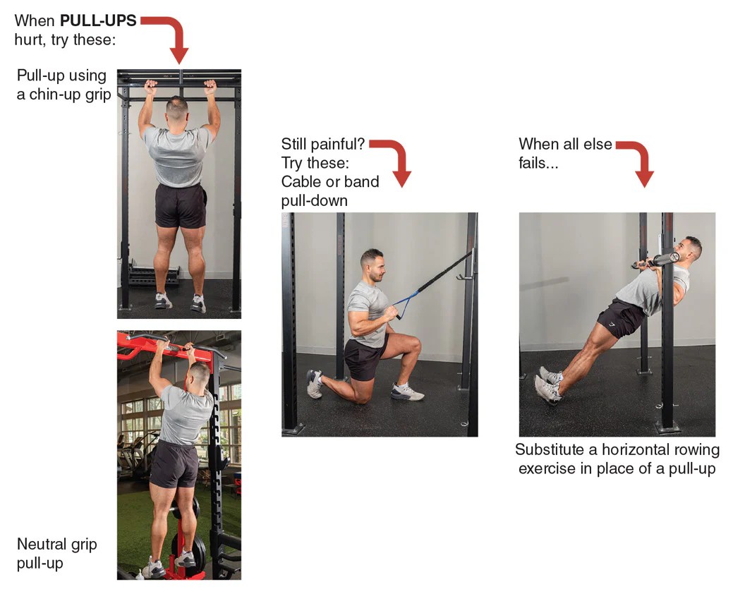 Figure 8.3 Pull-up modification ladder for shoulder pain.