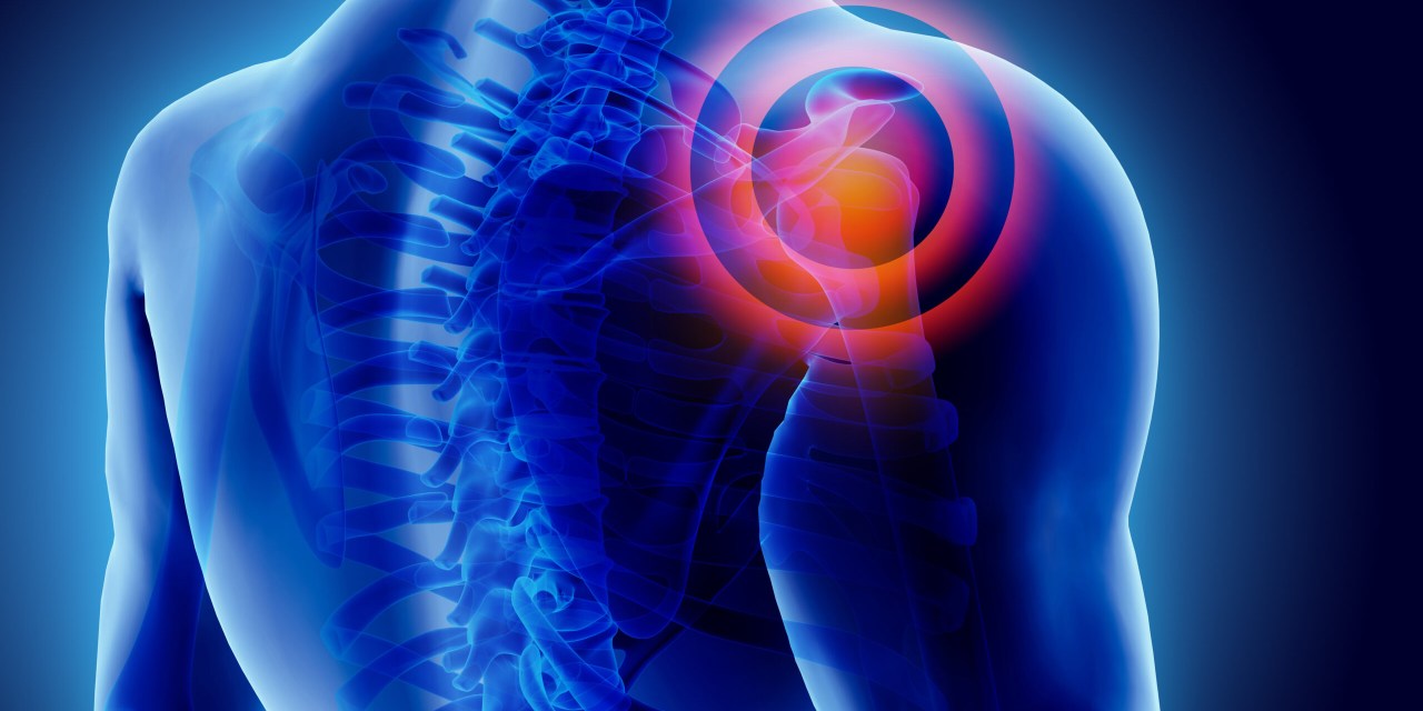 How to Modify Weight Training Due to Shoulder Pain